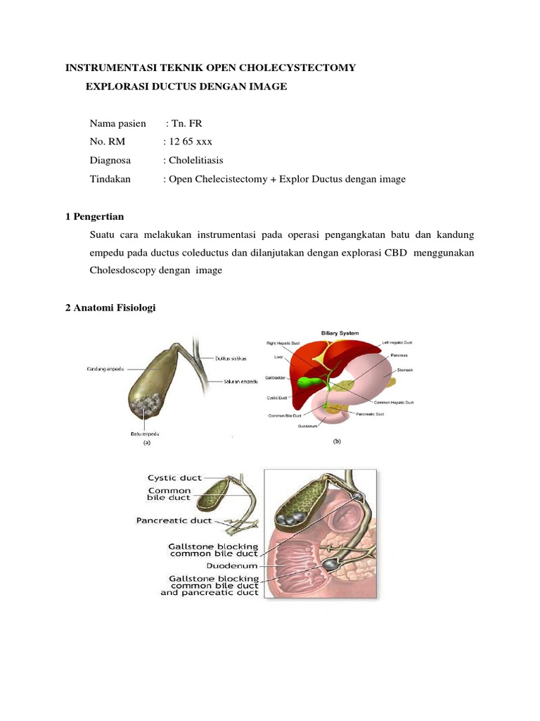 Teknik Open Cholecystectomy dan CBD | PDF