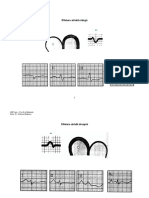2 EKG Hipertrofie Si Ischemie-1 PDF