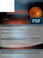 Retinopatía Hipertensiva