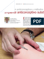 Implante Subdérmico Métodos Anticonceptívos Ginecología 2014 06