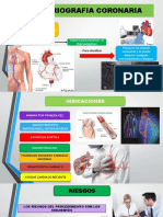 Arteriografia Coronaria