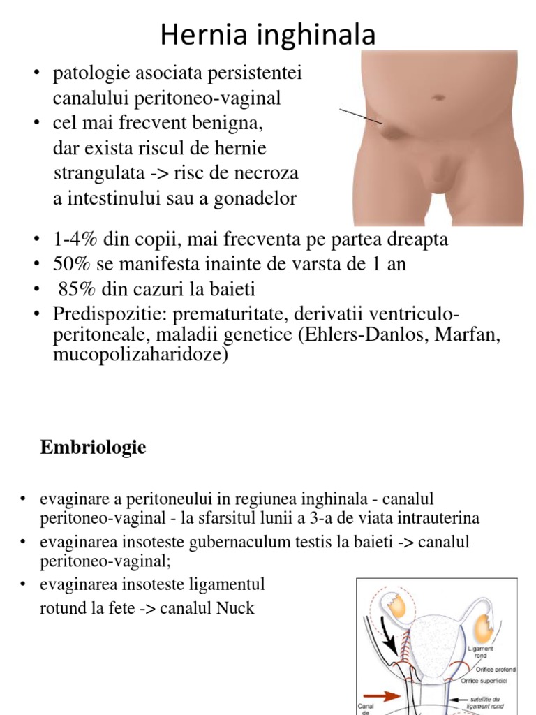 Hernia Inghinala 16 17 Pdf