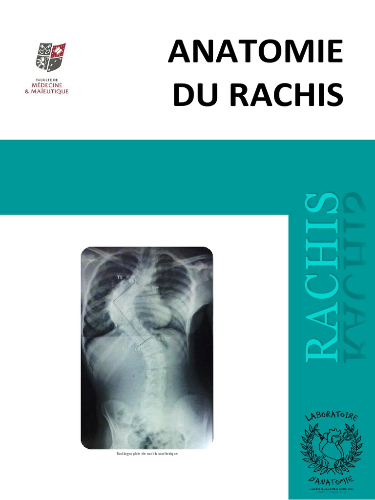 Anatomie du Rachis et Scoliose | PDF | Vertèbre | Colonne vertébrale