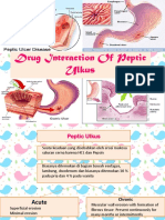 Drug Interaction of Peptic Ulkus