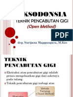 Eksodonsia Open Method