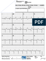 Ecg Luis Araya Pino