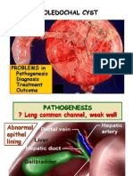 Kista Duktus Choledocus