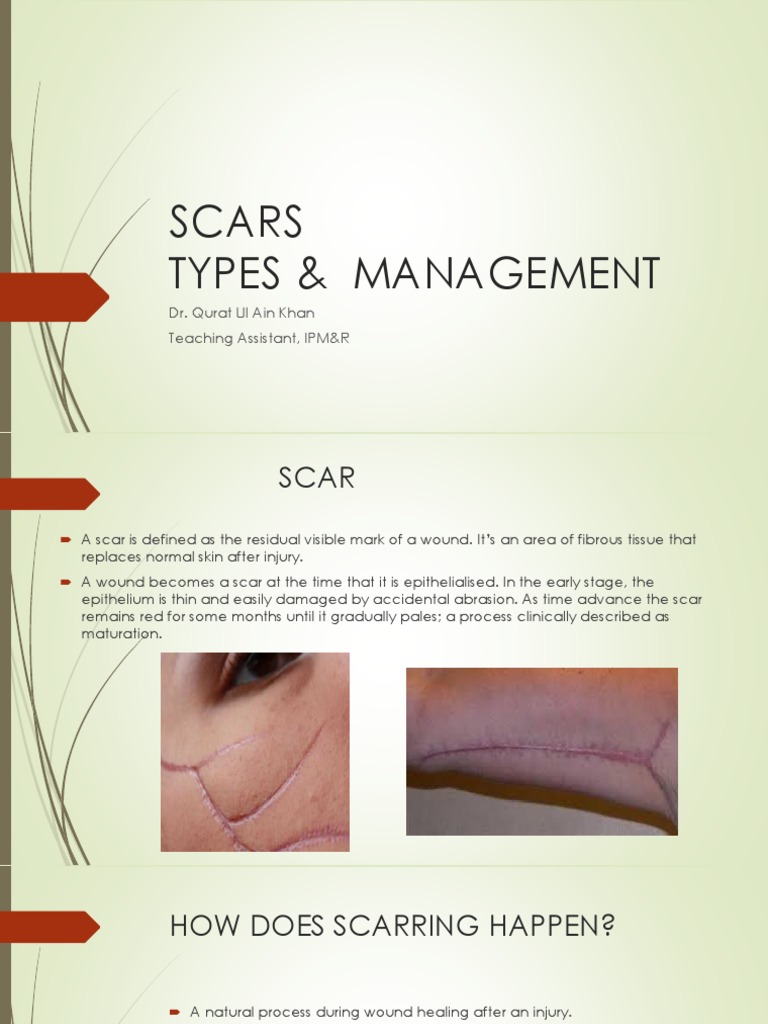 Scar Management Techniques Explained | PDF | Scar | Massage