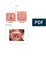 Diagnosis Banding Difteri Pada Anak