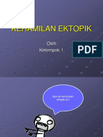 Kehamilan Ektopik PPT.ppt