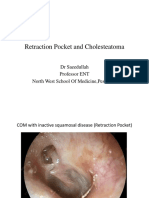 ENT Retraction Pocket and Cholesteatoma Stages Causes