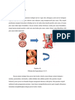 Paralisis Pita Suara