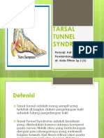 Tarsal Tunnel Syndrome2