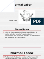 Labor