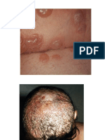 01-iulie-2009-11-IMAGINI-DERMATO.ppt