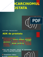 6. ADK de Prostata