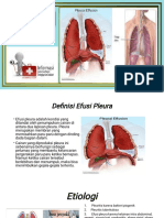 (Efusi Pleura PDF