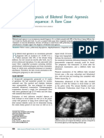 Rare Case of Bilateral Renal Agenesis with Potter’s Sequence