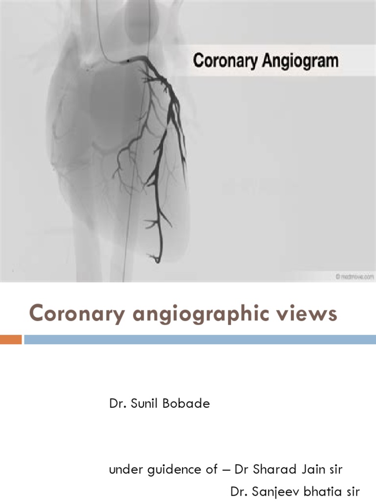 Cag Views Ppt Sunil Pdf Pdf Coronary Circulation Aorta