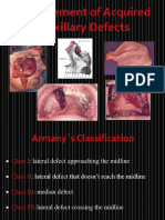 Management of Acquired Maxillary Defects Partially Edentlous PDF