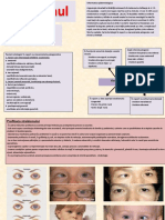 Strabismul Conform PCN