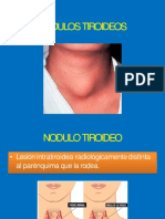 nodulos tiroideos-convertido