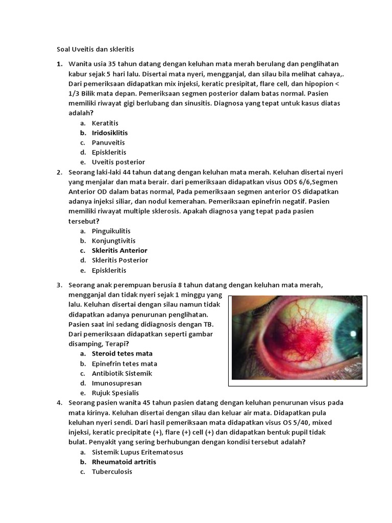 Diagnosa Uveitis dan Skleritis pada Pasien | PDF