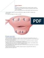 Tehnik Compression uterine sutures Sutures