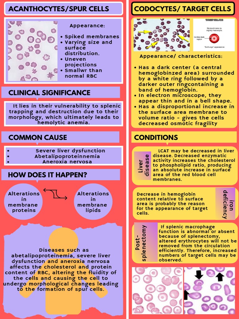 Acanthocytes and Target Cells in Anemia | PDF | Red Blood Cell | Cell ...