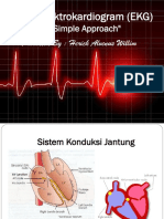 Tentir EKG