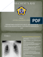 TUGAS CHEST X-RAY