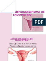 Adenocarcinoma de Endometrio