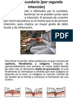 Cierre Secundario (Por Segunda Intención) | PDF