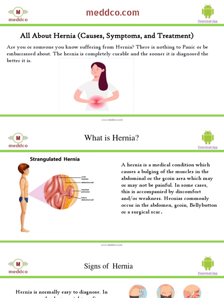 All About Hernia (Causes, Symptoms, and Treatment) | PDF | Clinical