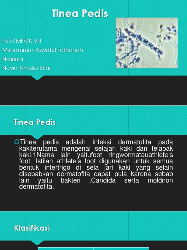Tinea Pedis | PDF