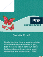 Gastritis Erosif