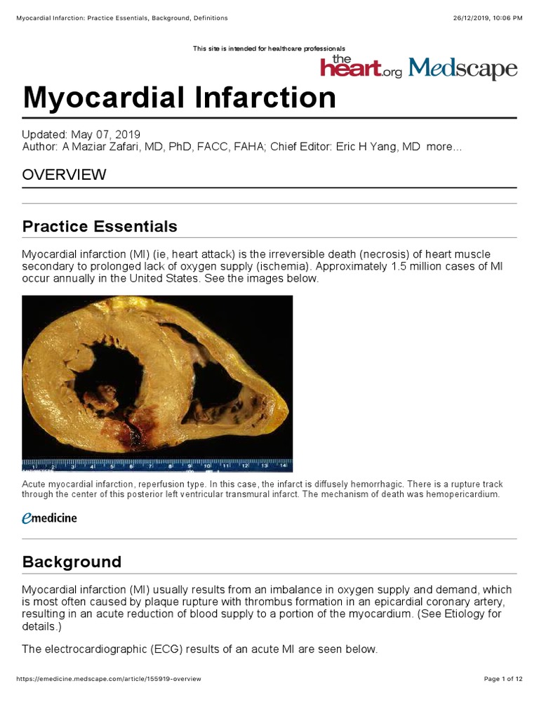 Myocardial Infarction Overview and Types | PDF | Myocardial Infarction ...