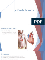 Coartación de la aorta