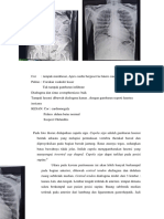 Pembahasan Pneumoperitoneum