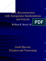 ACL_Reconstruction_with_Autogenous_Semitendonosis_and_Gracilis_-_Beach