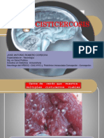 NEUROCISTICERCOSIS EXPOSICION Clase