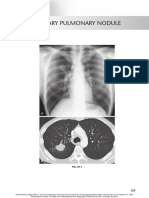 chest radio 20 solitary pulmonary nodule