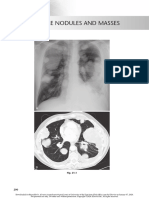 chest radio 21 multiple nodules and masses