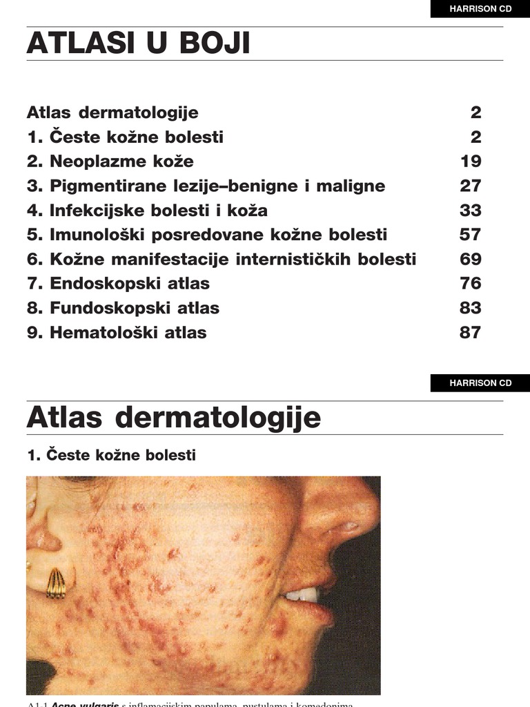 ATLASI | PDF