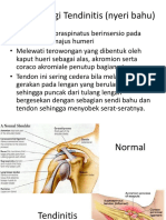 Patofisiologi Tendinitis (Nyeri Bahu)