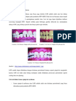 Linear Gingival Erythema