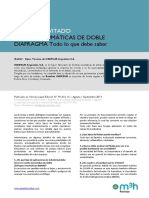 Bombas Neumáticas de Doble Diafragma Lo Que Debe Saber