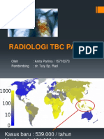 Referat Tuberkulosis