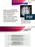 230548051-PPT-Epilepsi.pptx