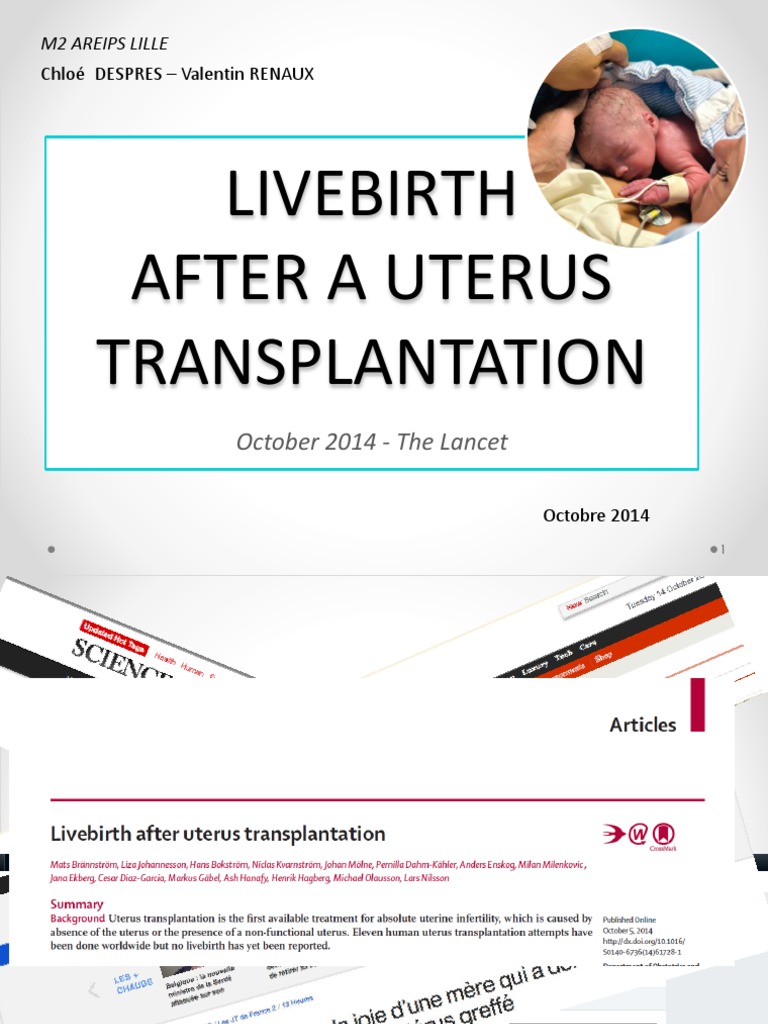 Uterus Transplantation | PDF | Uterus | Sexual Anatomy